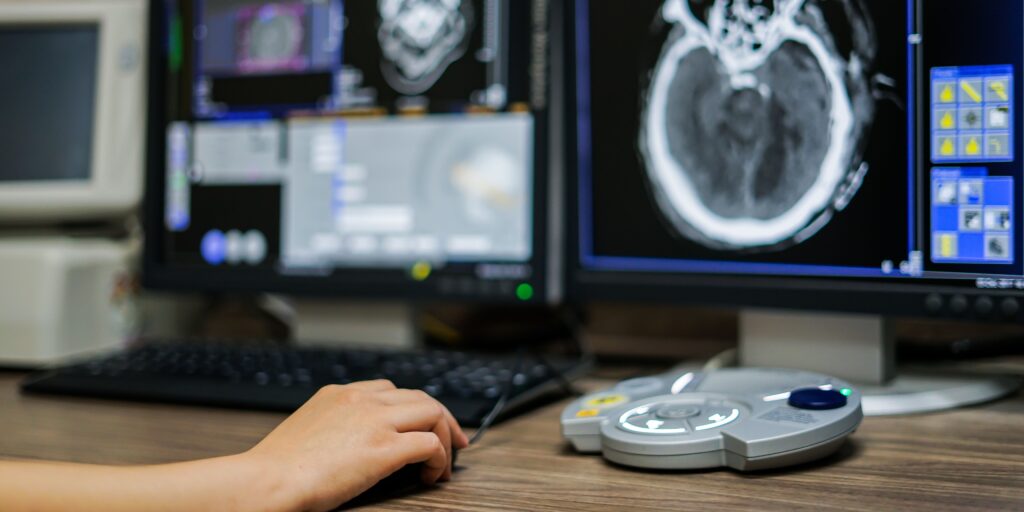 The Marvels of CT Scan: Exploring Cutting-Edge Medical Imaging
